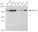 ROCK2 Antibody in Western Blot (WB)