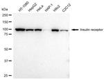 INSR Antibody in Western Blot (WB)