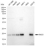 RAC3 Antibody in Western Blot (WB)