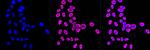 NME1 Antibody in Immunocytochemistry (ICC/IF)