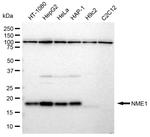 NME1 Antibody in Western Blot (WB)