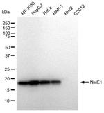 NME1 Antibody in Western Blot (WB)