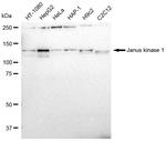 JAK1 Antibody in Western Blot (WB)