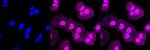 PAK2 Antibody in Immunocytochemistry (ICC/IF)