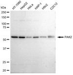 PAK2 Antibody in Western Blot (WB)