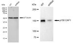 CAF1 p150 Antibody