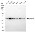 CHMP2B Antibody in Western Blot (WB)