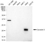 Caveolin 3 Antibody in Western Blot (WB)