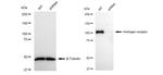 Androgen Receptor Antibody