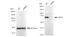 ABCD1 Antibody