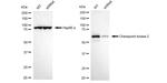 CHK2 Antibody