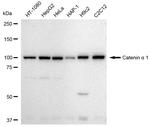 Catenin alpha-1 Antibody in Western Blot (WB)