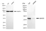 ABHD5 Antibody