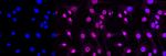 AP2S1 Antibody in Immunocytochemistry (ICC/IF)