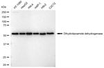 DLD Antibody in Western Blot (WB)