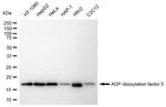 ARF5 Antibody in Western Blot (WB)