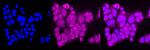 Calnexin Antibody in Immunocytochemistry (ICC/IF)