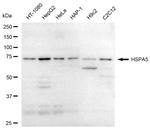 GRP78 Antibody in Western Blot (WB)