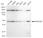 LIS1 Antibody in Western Blot (WB)