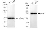 PFKM Antibody