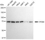 PFKM Antibody in Western Blot (WB)