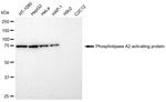 PLAA Antibody in Western Blot (WB)