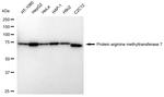 PRMT7 Antibody in Western Blot (WB)