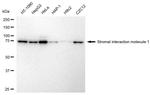 STIM1 Antibody in Western Blot (WB)