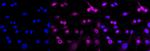 MUNC18 Antibody in Immunocytochemistry (ICC/IF)