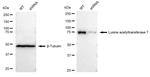 MYST2 Antibody