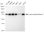 MYST2 Antibody in Western Blot (WB)