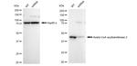 ACAA2 Antibody