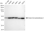 ACAA2 Antibody in Western Blot (WB)