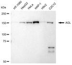 AGL Antibody in Western Blot (WB)