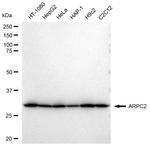 ARPC2 Antibody in Western Blot (WB)