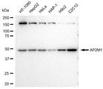 AP2M1 Antibody in Western Blot (WB)