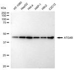 ATG4B Antibody in Western Blot (WB)