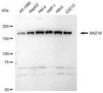 BAZ1B Antibody in Western Blot (WB)