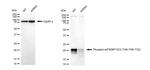 Phospho-4EBP1/2/3 (Thr46, Thr32) Antibody