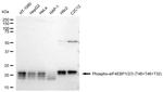 Phospho-4EBP1/2/3 (Thr46, Thr32) Antibody in Western Blot (WB)