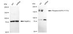 Phospho-EGFR (Tyr1173) Antibody