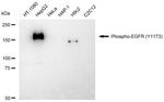 Phospho-EGFR (Tyr1173) Antibody in Western Blot (WB)