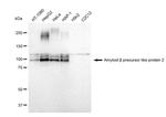 APLP2 Antibody in Western Blot (WB)