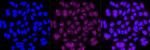 ATP7B Antibody in Immunocytochemistry (ICC/IF)