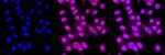 APPL1 Antibody in Immunocytochemistry (ICC/IF)