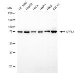 APPL1 Antibody in Western Blot (WB)