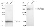 SMARCC1 Antibody