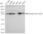 Phospho-STAT1 (Ser727) Antibody in Western Blot (WB)