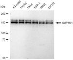 SPT5 Antibody in Western Blot (WB)