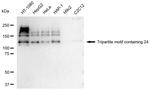 TRIM24 Antibody in Western Blot (WB)